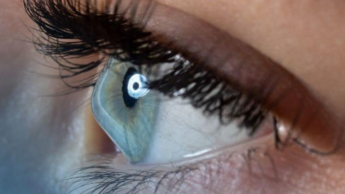 Abu Dhabi: Hospital study finds blinding eye disease in teens – News