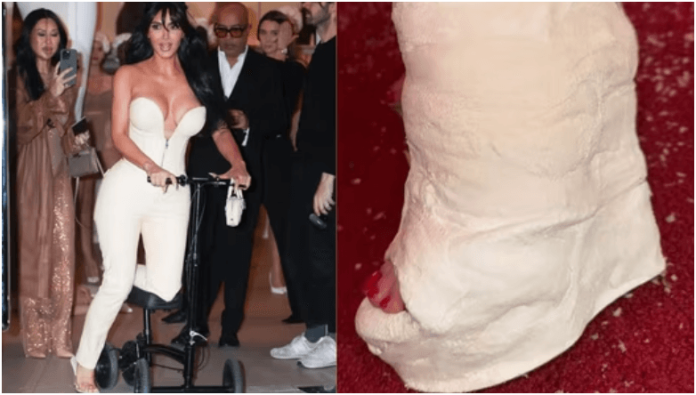 Kim Kardashian Transforms Broken Foot into Fashion Statement with Trendy Wedge Heel-Inspired Cast